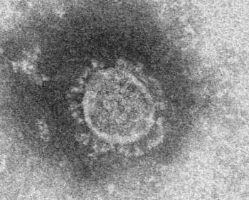 新型コロナウイルスの電子顕微鏡写真=国立感染症研究所提供(共同)