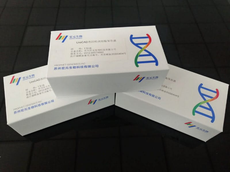自宅で手軽にできる泌尿器がん検査キット「UroCAD」(宏元生物提供) 自宅で手軽にできる泌尿器がん検査キット「UroCAD」(宏元生物提供)