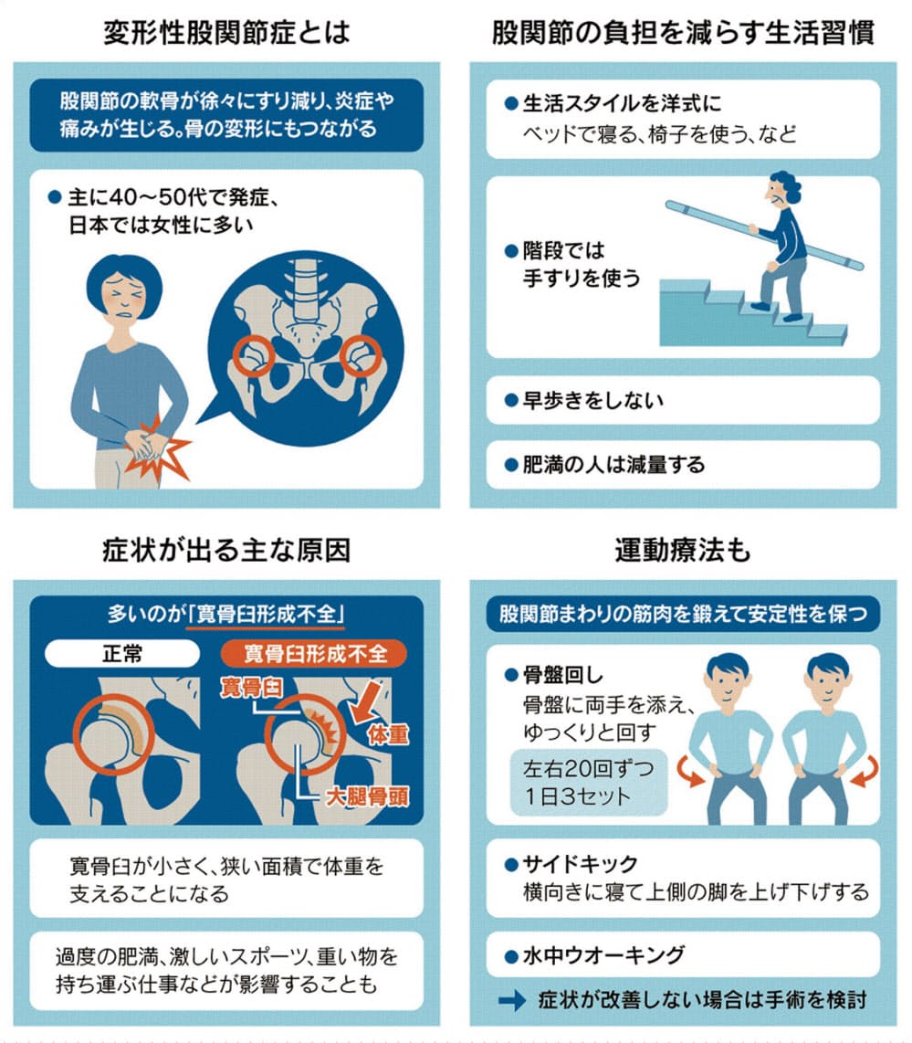 股関節の痛み 放置は禁物 骨盤回しで筋肉鍛え対策 Nikkei Style 股関節の痛み 放置は禁物 骨盤回しで筋肉鍛え対策 Nikkei Style