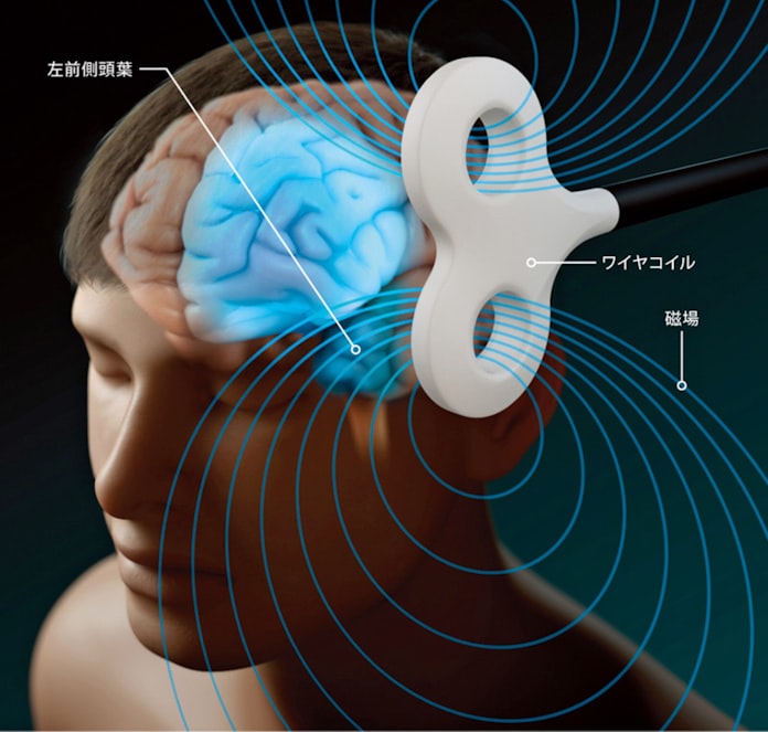 ある日 天才 が目覚める 脳が秘める無限の可能性 日本経済新聞