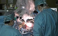 東京医科大病院の秋元治朗教授(左)らによるPDT手術の様子。レーザ光を照射して化学反応を引き起こしがん細胞を変性・壊死させる