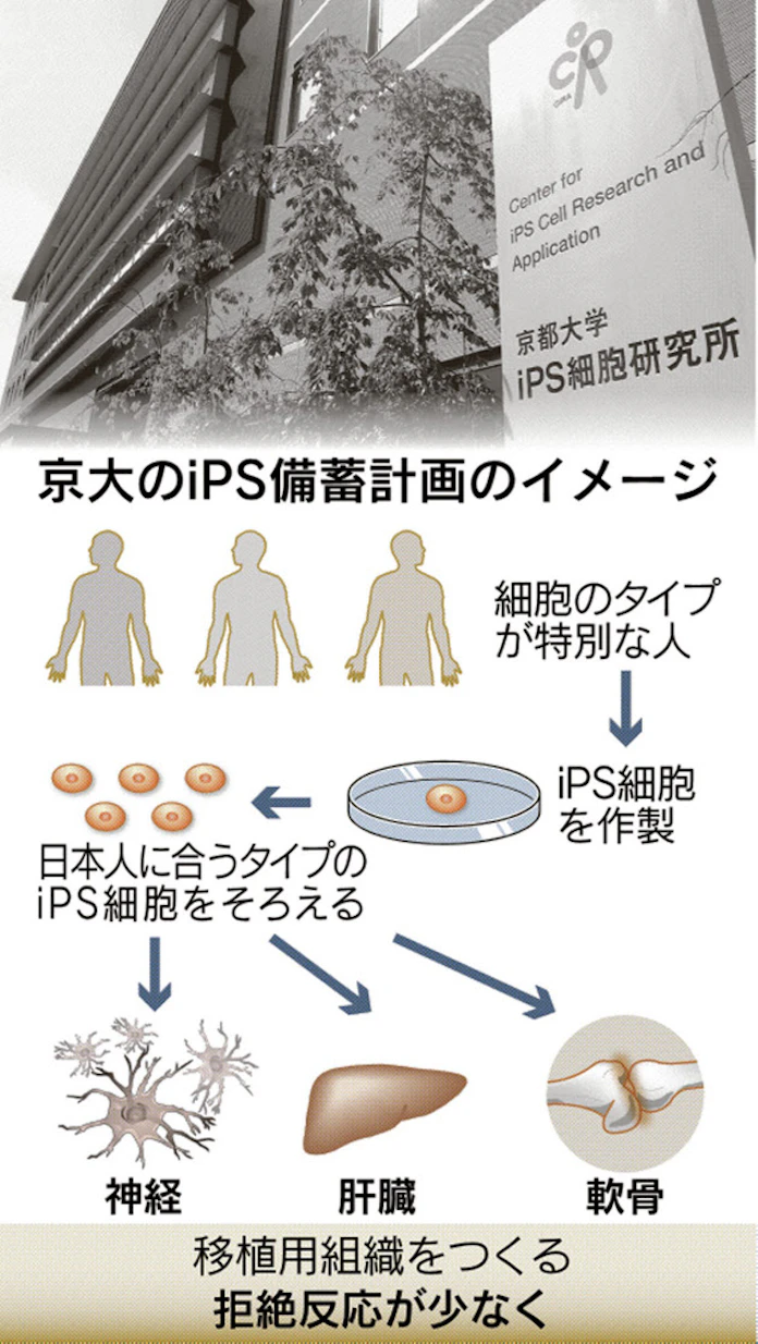 日本人に合うipsを備蓄 京大 今秋から提供 日本経済新聞