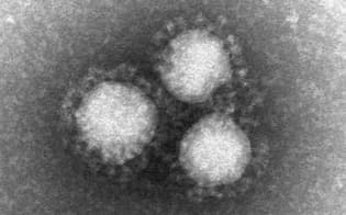 MERSコロナウイルスの電子顕微鏡写真=国立感染症研究所提供
