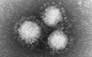 MERSコロナウイルスの電子顕微鏡写真=国立感染症研究所提供