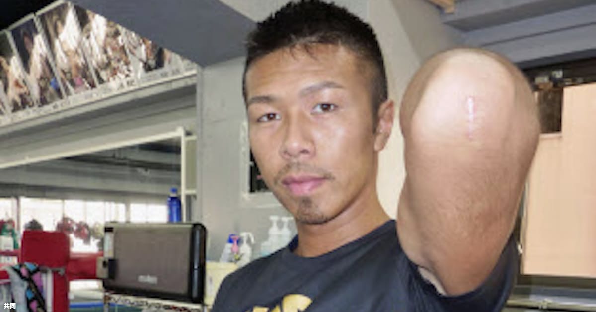 Wba王者内山 肘手術から練習再開 10連続防衛中 日本経済新聞