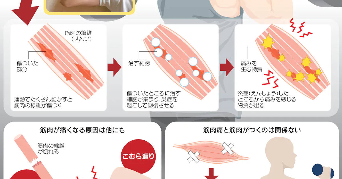 筋肉痛はなぜ起こるの 親子スクール 日本経済新聞