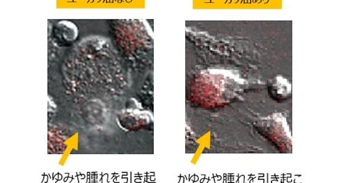 ユーカリ油にアレルギー抑制効果 池田模範堂が発表 日本経済新聞 ユーカリ油にアレルギー抑制効果 池田模範堂が発表 日本経済新聞