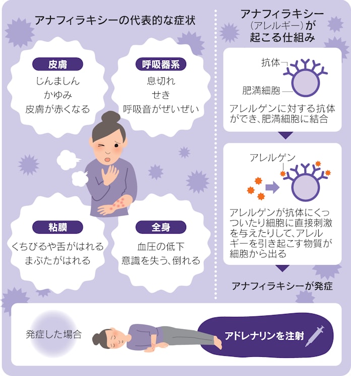 新型コロナ コロナワクチン接種でアナフィラキシー 国内2例目 日本経済新聞 新型コロナ コロナワクチン接種でアナフィラキシー 国内2例目 日本経済新聞