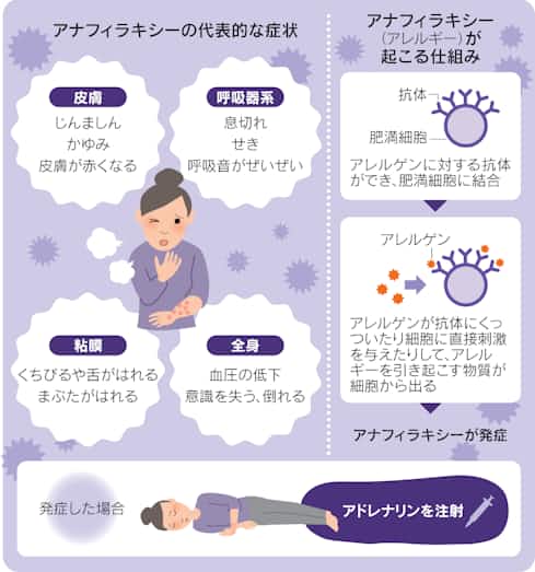 ã¢ããã£ã©ãã·ã¼å½å
3ä¾ç® æ°åã³ããã¯ã¯ãã³ æ¥æ¬çµæ¸æ°è