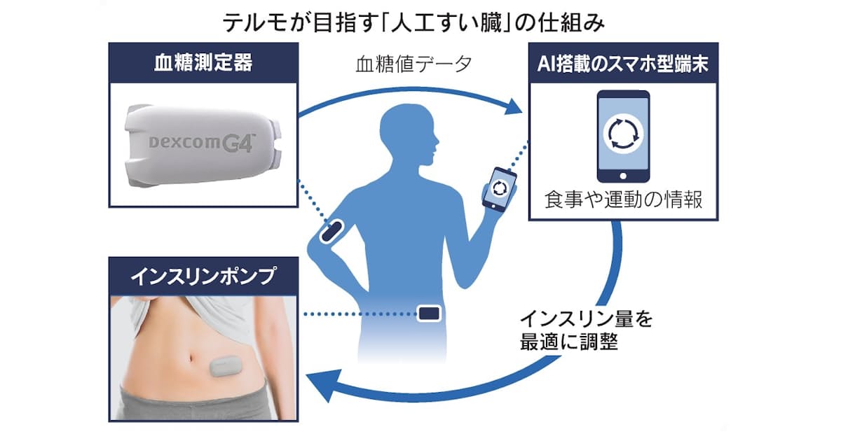 テルモ 糖尿病注射いらず Aiがインスリン自動投与 日本経済新聞 テルモ 糖尿病注射いらず Aiがインスリン自動投与 日本経済新聞