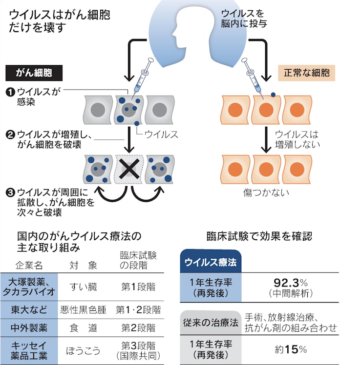 がん破壊 ウイルスに託す 脳腫瘍以外でも開発競う 日本経済新聞