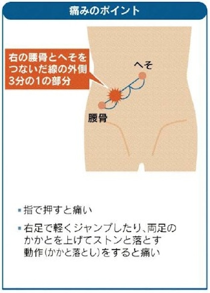 実は夏に多い虫垂炎 右下腹に痛み 再発リスク意識して 日本経済新聞 実は夏に多い虫垂炎 右下腹に痛み 再発リスク意識して 日本経済新聞