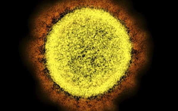 新型コロナウイルスの電子顕微鏡写真（米国立アレルギー感染症研究所提供）＝共同