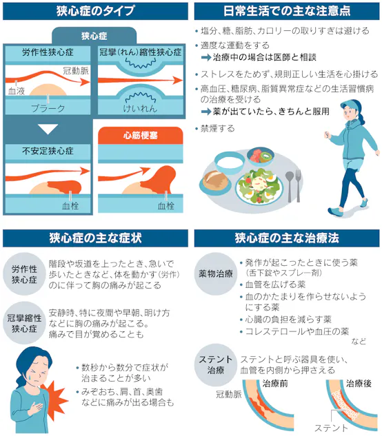 虚血性心疾患 Minds版やさしい解説 Mindsガイドラインライブラリ
