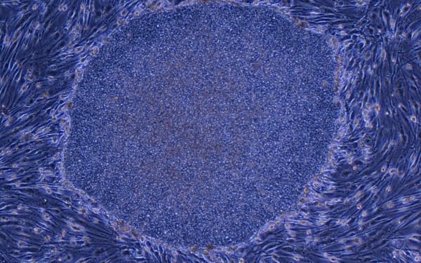 カナダ 安楽死の対象拡大で法案可決 精神疾患も容認へ 日本経済新聞