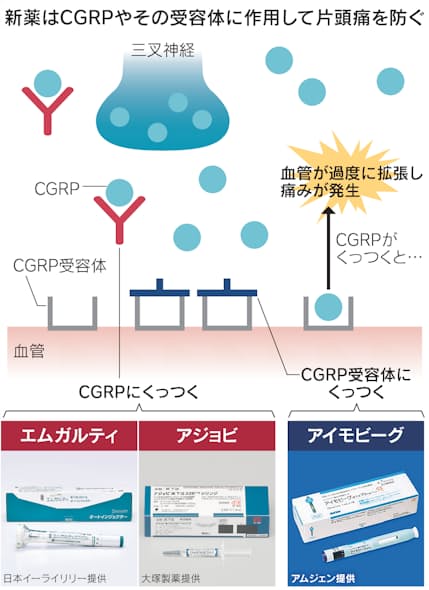 さらば片頭痛 予防できる日常到来 新薬は原因に作用 日本経済新聞 さらば片頭痛 予防できる日常到来 新薬は原因に作用 日本経済新聞