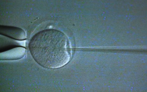 卵子に精子が送り込まれる顕微授精の様子（東京都中央区の不妊治療クリニック）