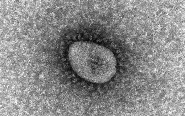 新型コロナウイルス変異型「オミクロン型」の電子顕微鏡写真＝国立感染症研究所提供・共同