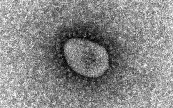国立感染症研究所が分離した、新型コロナウイルスのオミクロン株の電子顕微鏡写真（同研究所提供）