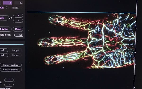 光超音波イメージングで画像化した血管。色で血管の位置情報を示している（写真：日経クロステック）