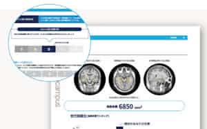 医療機関はMRI画像をソフトにアップロードするだけで診断結果が作成できる