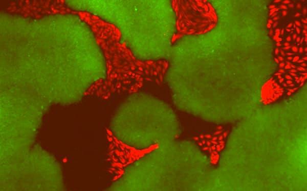 ヒトのｉＰＳ細胞とがん細胞を混ぜて培養＝京都大学ｉＰＳ細胞研究所提供