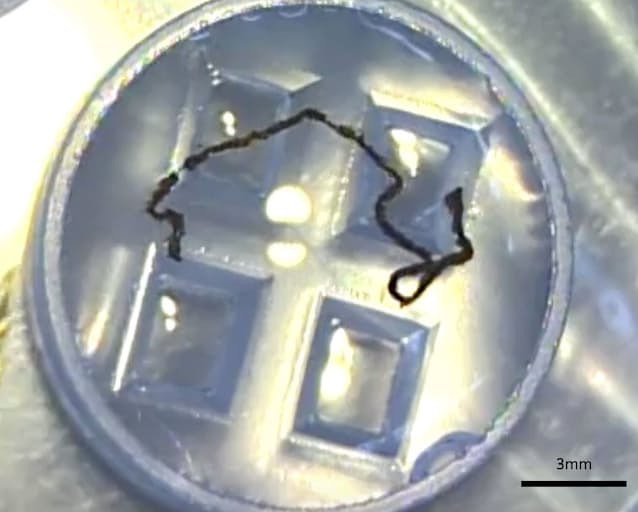 ひも状ips網膜移植へ 神戸の病院 臨床研究開始 日本経済新聞 ひも状ips網膜移植へ 神戸の病院 臨床研究開始 日本経済新聞