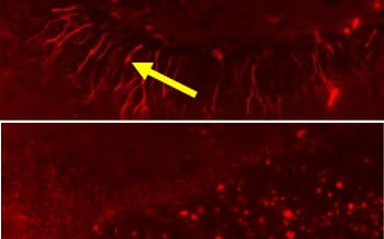 マウスの海馬の様子。若い個体（上）には神経細胞がみられる。高齢個体に幹細胞を投与すると神経細胞が増加した（下）＝神戸医療産業都市推進機構・田口明彦部長
