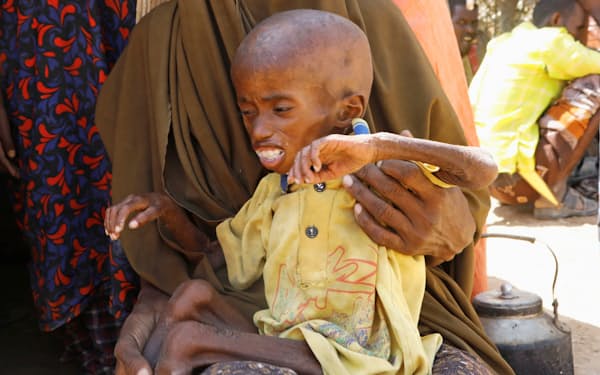 食糧危機が子どもを襲う（3月、ソマリアの避難民キャンプ）=ロイター
