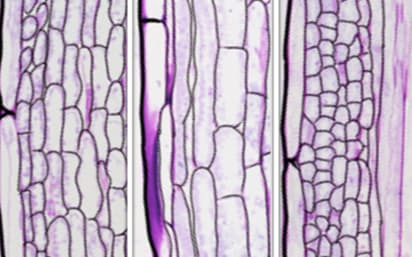 「SCL28」遺伝子の働きを強めると細胞が肥大化（中央）、弱めると縮小した（右）。左 は元の細胞＝金沢大学の伊藤正樹教授提供