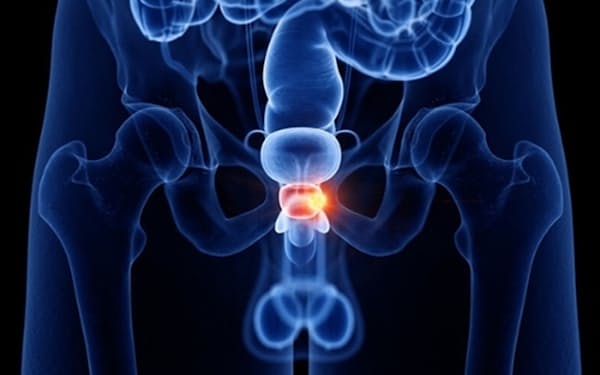 前立腺は男性にのみある臓器。膀胱の下に位置し、くるみほどの大きさだ（写真はイメージ=123RF）