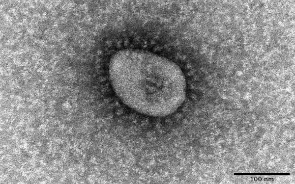 新型コロナウイルス・オミクロン型の電子顕微鏡写真（国立感染症研究所提供）＝共同