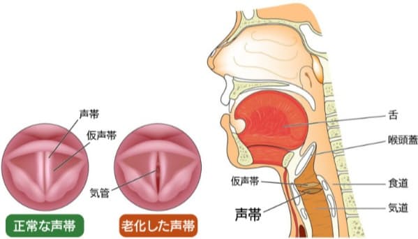 答えと解説 声がかすれて出にくい 声帯のダメージを防ぐには Nikkei Style 答えと解説 声がかすれて出にくい 声帯のダメージを防ぐには Nikkei Style