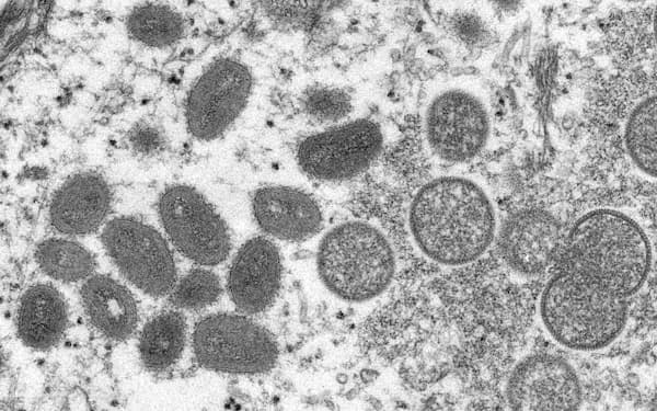 天然痘に似たサル痘の感染が欧米で報告された＝ロイター
