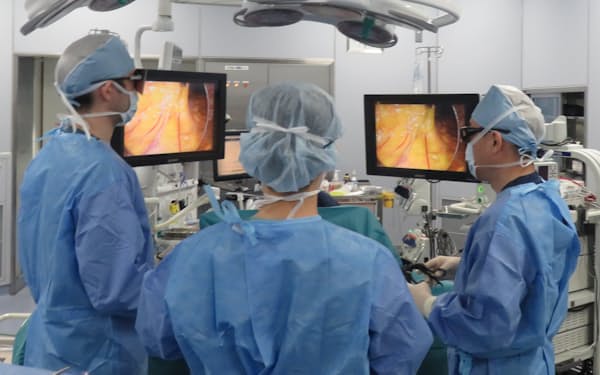 複数の医師が細長い器具を差し込んで画像を見ながら切除する腹腔鏡手術の割合は増加している（四国がんセンター提供）