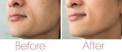 シミ クマ ヒゲそり跡 バレない補正メーク術 Nikkei Style シミ クマ ヒゲそり跡 バレない補正メーク術 Nikkei Style