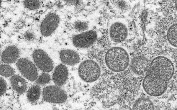 サル痘のウイルス粒子を電子顕微鏡で撮影した画像（2003年）＝米疾病対策センター（CDC）提供・AP