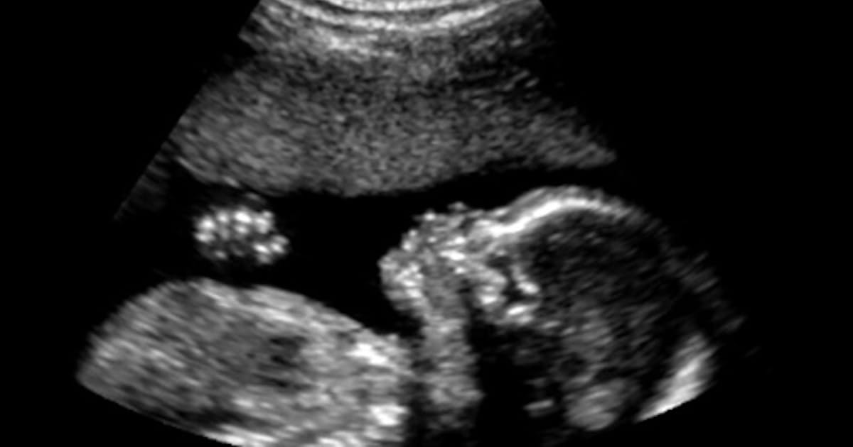 妊娠中の飲酒が子どもの脳に与える影響 研究進む 日本経済新聞 妊娠中の飲酒が子どもの脳に与える影響 研究進む 日本経済新聞