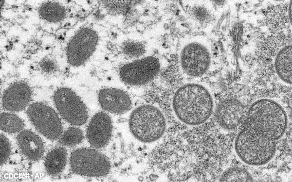 FILE - This 2003 electron microscope image made available by the U.S. Centers for Disease Control and Prevention shows mature, oval-shaped monkeypox virions, left, and spherical immature virions, right, obtained from a sample of human skin associated with the 2003 prairie dog outbreak. Two children have been diagnosed with monkeypox in the United States: a toddler in California and an infant who is not a U.S. resident, health officials said Friday, July 22, 2022. (Cynthia S. Goldsmith, Russell Regner/CDC via AP, File)