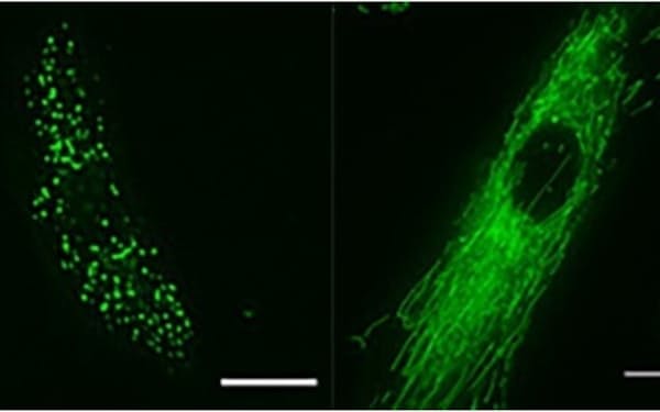 ミトコンドリアが断片化して機能不全に陥っている細胞（左）に開発した薬剤を加えたところ、網目状の構造をもつ正常なミトコンドリアが再生した（右）＝有本博一・東北大学教授提供