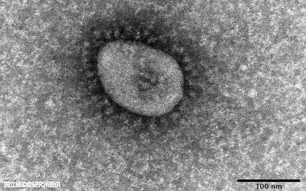 ⑤オミクロン型で「第6波」「第7波」の猛威、世界最多の感染 新型コロナウイルス・オミクロン株の電子顕微鏡写真(国立感染症研究所提供)