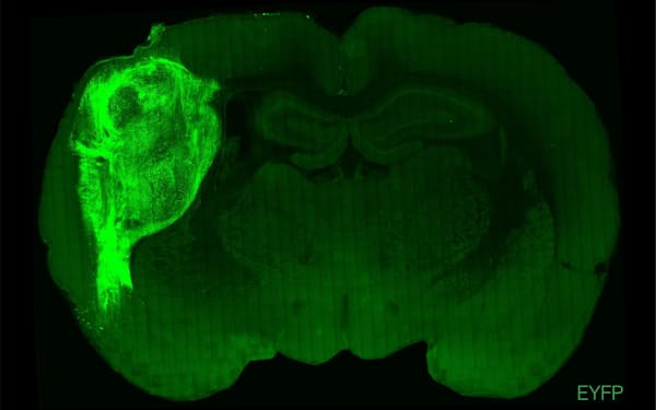 ラットの脳内に移植された人のミニ脳（明るく光る緑の部分）＝スタンフォード大学提供
