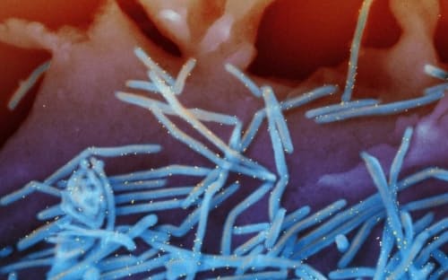 RSウイルス（呼吸器合胞体ウイルス）の電子顕微鏡写真。抗RSウイルスFタンパク質抗体（黄色）で標識したウイルス粒子（青色）が、ヒトの肺細胞の表面からはがれる様子。2022年は米国でRSウイルスが例年になく早い時期から流行している。（PHOTOGRAPH BY NIAID）