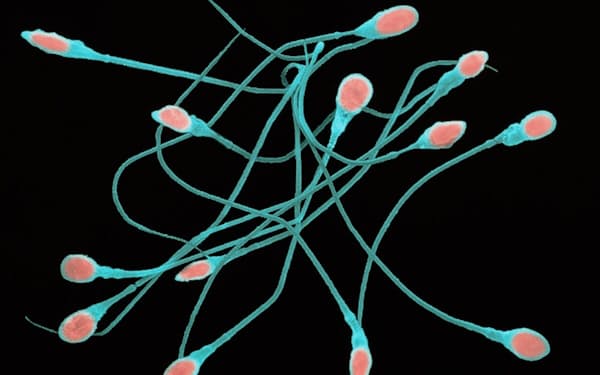 成熟したヒトの精子を、カラー走査電子顕微鏡で撮影したもの。それぞれの精子は全長が約65ミクロンで、大きく頭（赤い部分）、首、尾（青い部分）に分けられる。（MICROGRAPH BY DR TONY BRAIN, SCIENCE PHOTO LIBRARY）