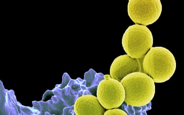 メチシリン耐性黄色ブドウ球菌（MRSA）などの薬剤耐性菌は医療現場の課題となっている＝米国立アレルギー感染症研究所提供