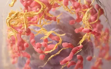 メラノーマ細胞の3次元微細構造スキャンの着色画像。最新の研究により、フェロトーシス制御タンパク質1(FSP1)を阻害すると、マウスの転移性メラノーマ細胞が細胞死しやすくなることが示された。(SRIRAM SUBRAMANIAM, NATIONAL INSTITUTES OF HEALTH/SCIENCE PHOTO LIBRARY)