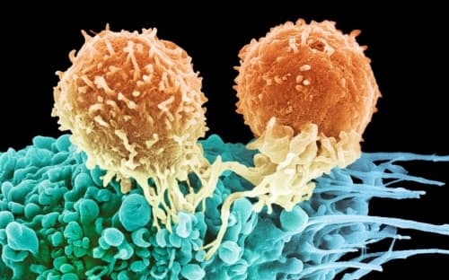がん細胞（緑色）に取りついた2つのT細胞（黄色）をとらえた走査電子顕微鏡（SEM）の着色写真。T細胞は白血球の一種で、体の免疫系を構成する要素の一つ。がん細胞の表面に特定の標的（抗原）を認識したT細胞は、その標的に結合し、他の免疫細胞にがん細胞の破壊を指示する。（MICROGRAPH BY STEVE GSCHMEISSNER, SCIENCE PHOTO LIBRARY）