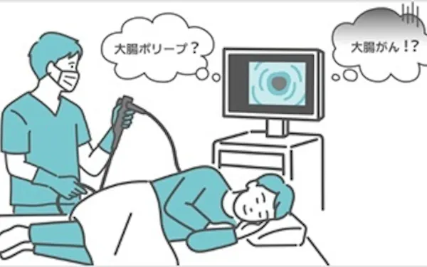 検診のプロが語る内視鏡検査のリアル