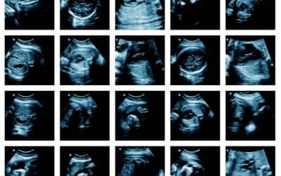 超音波で撮影された胎児の画像。（PHOTOGRAPH BY GIOVANNI GAGLIARDI / ALAMY）