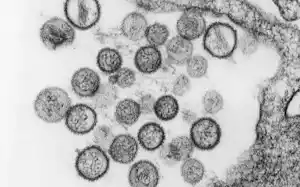 ハンタウイルスの電子顕微鏡画像=米疾病対策センター(CDC)提供 ハンタウイルスの電子顕微鏡画像=米疾病対策センター(CDC)提供